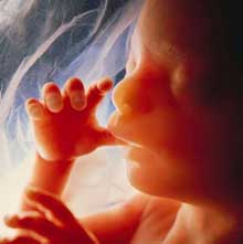 ِDrupping Fetus in Jewish-سقط جنین در یهود